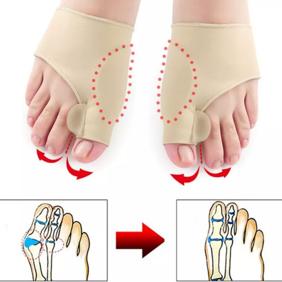 Protetor Joanete Corretivo Ortopédico